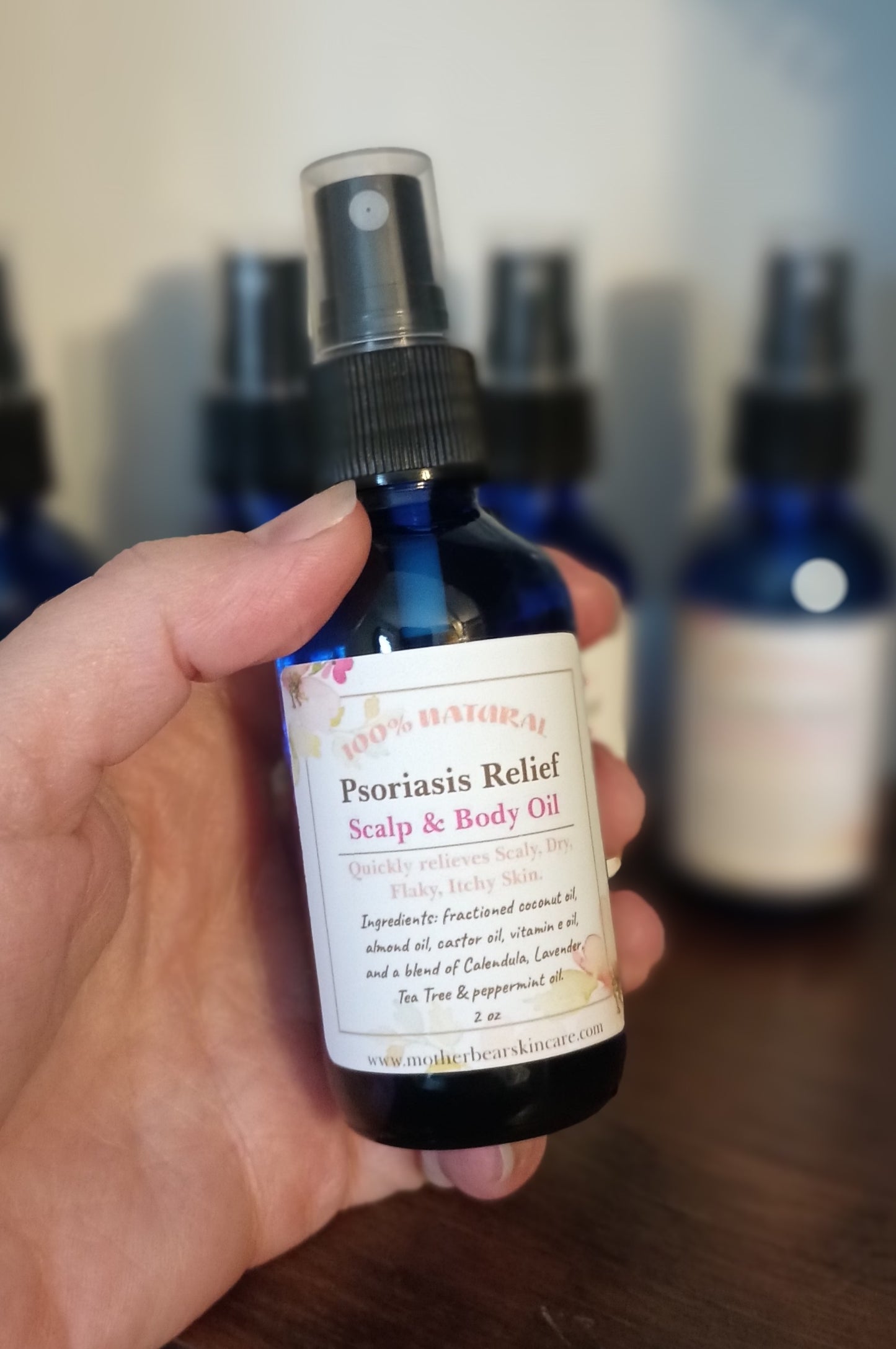 All-Natural Psoriasis Relief Scalp & Body Oil
