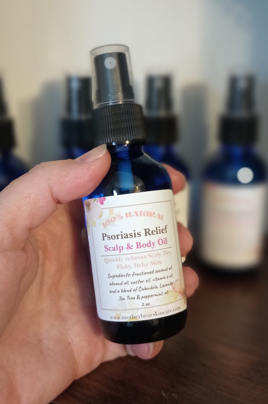 Psoriasis Relief Scalp & Body Oil